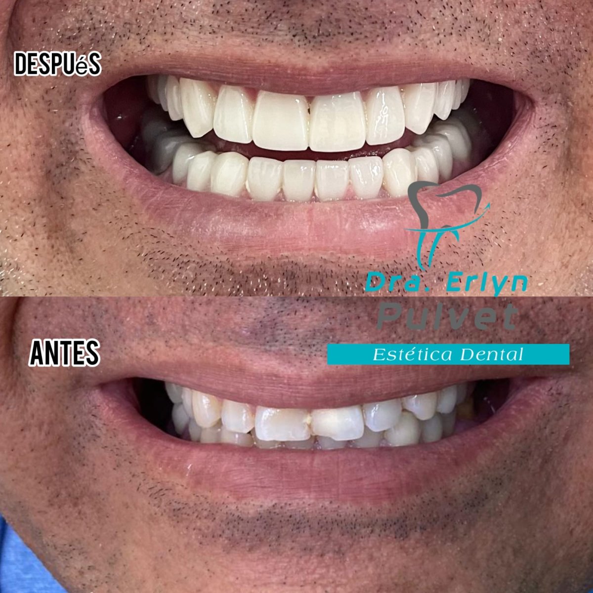 before and after photo