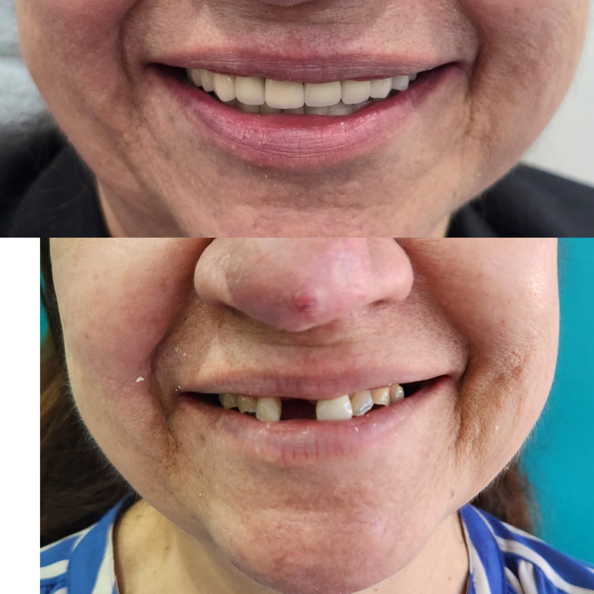 before and after photo