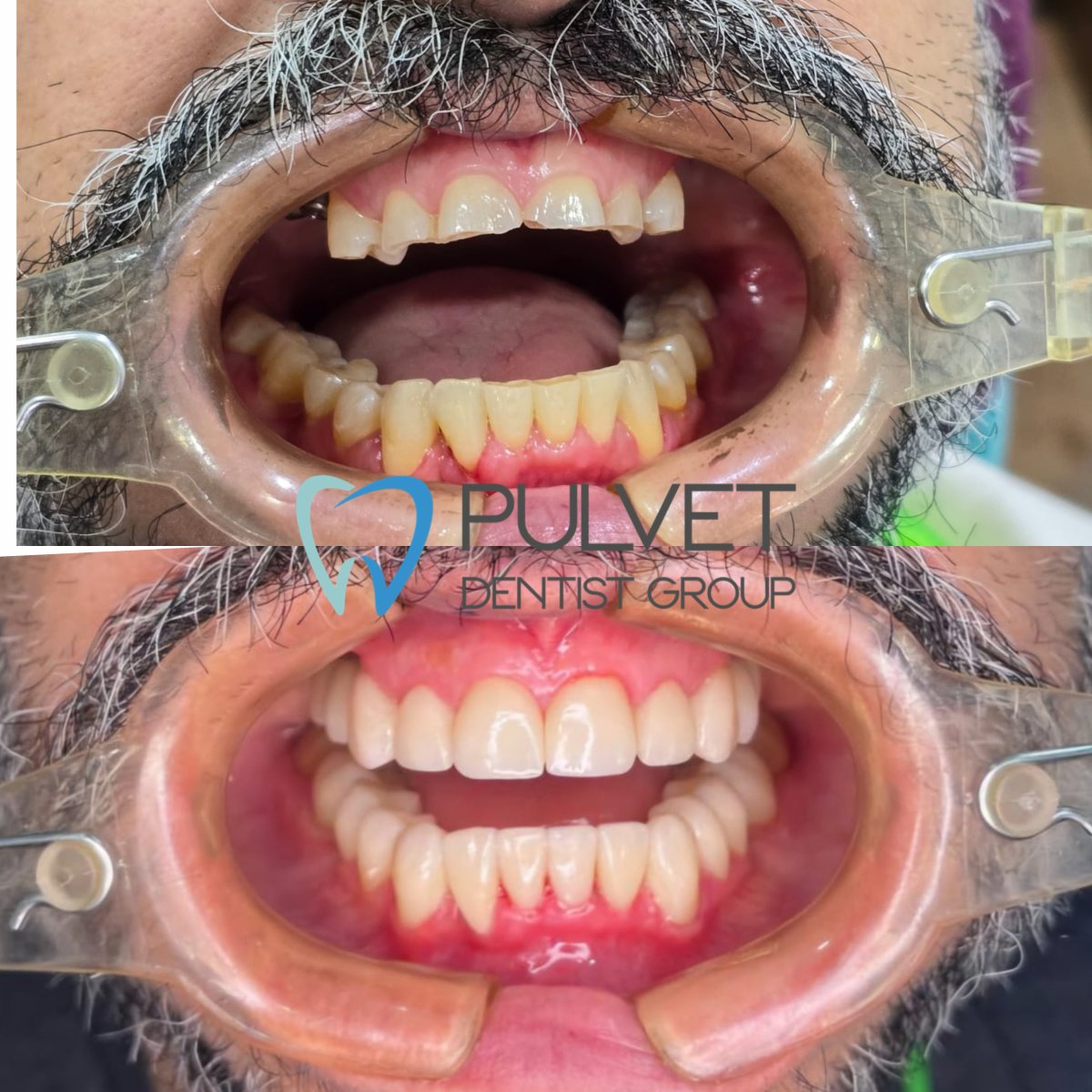 before and after photo