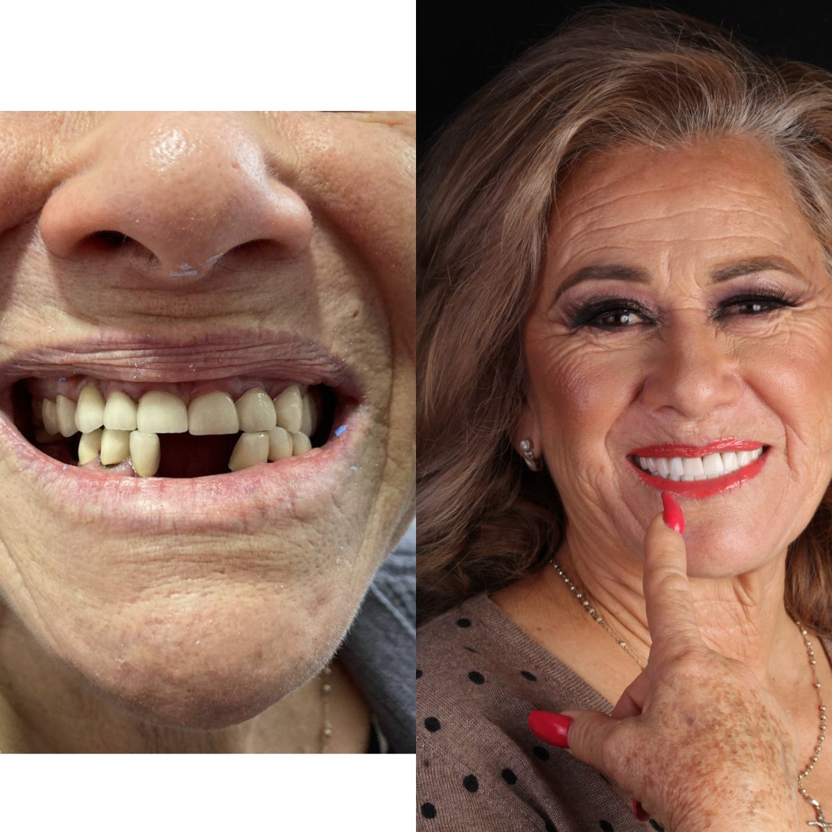 before and after photo