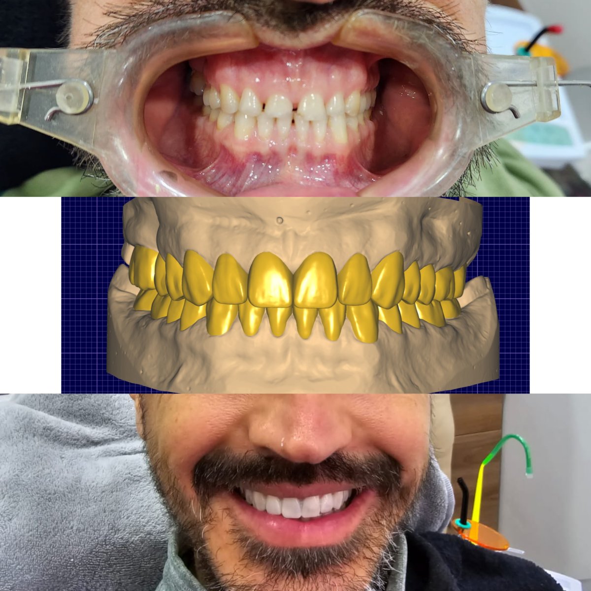 before and after photo