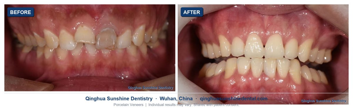 before and after photo