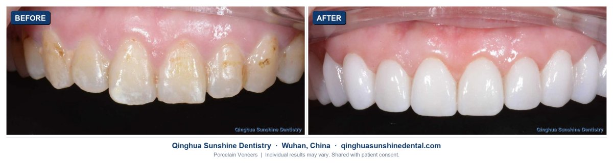 before and after photo