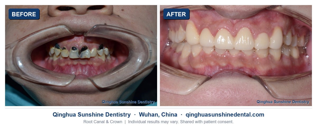 before and after photo