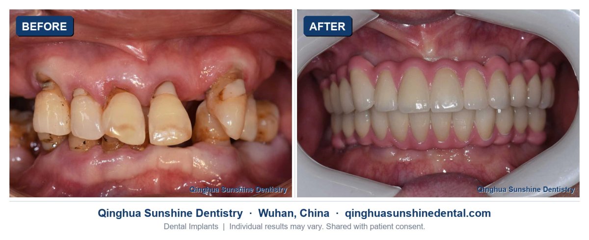 before and after photo