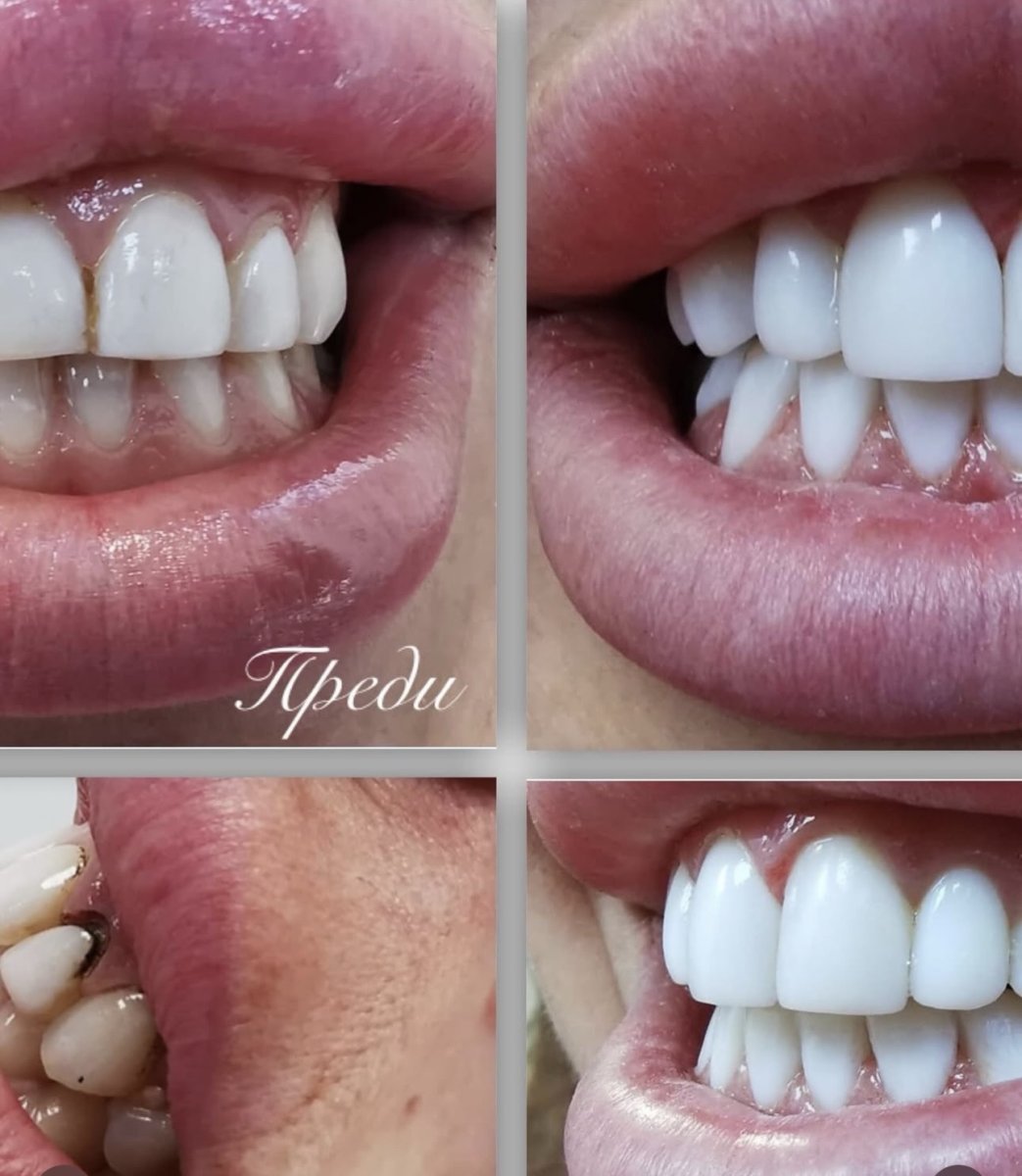 before and after photo