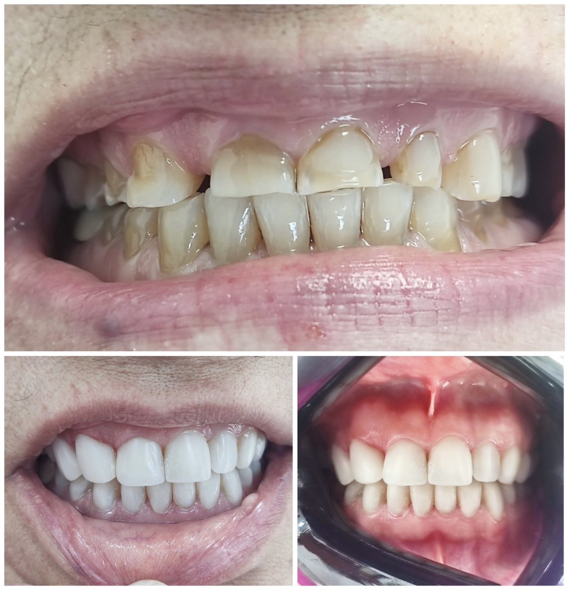 before and after photo