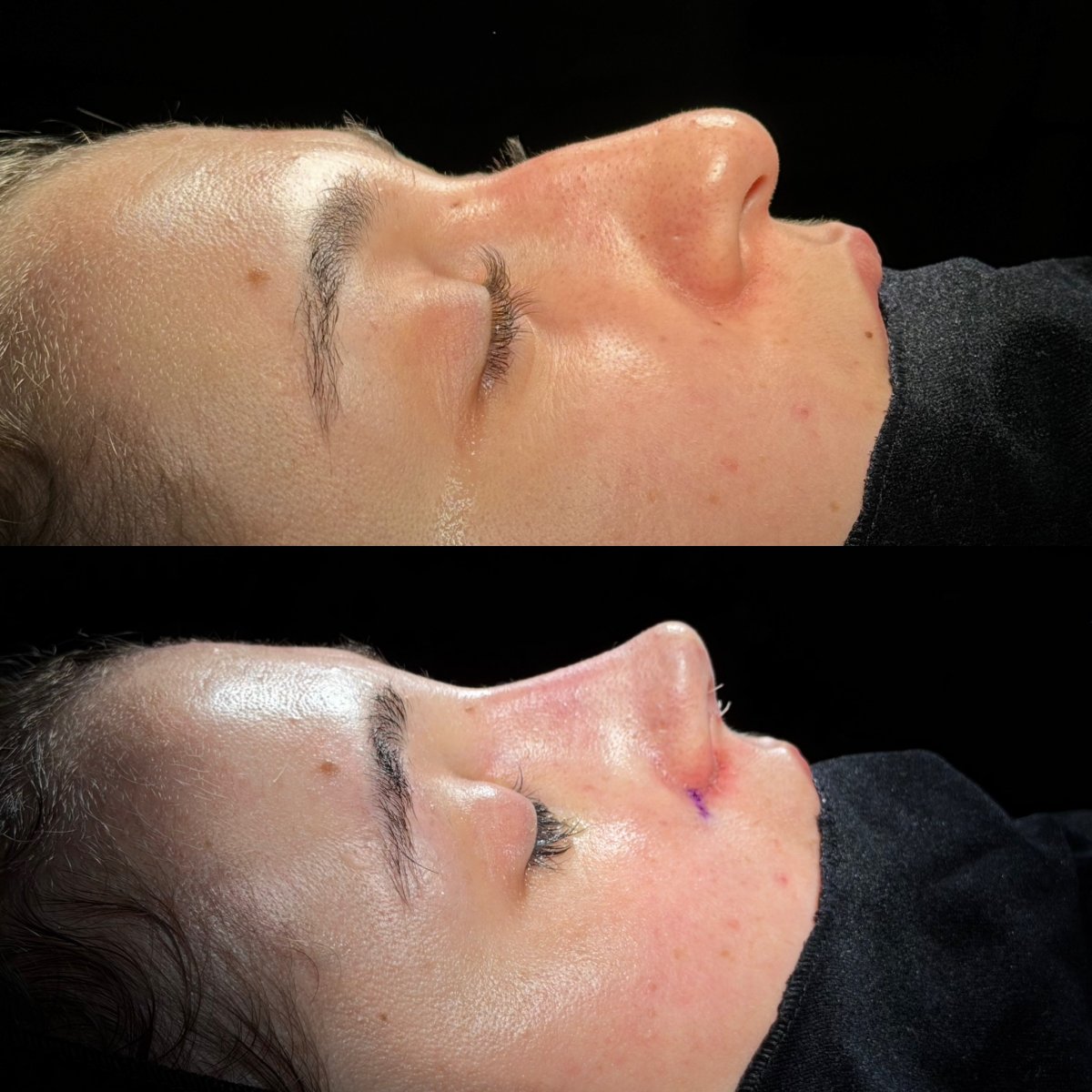 before and after photo