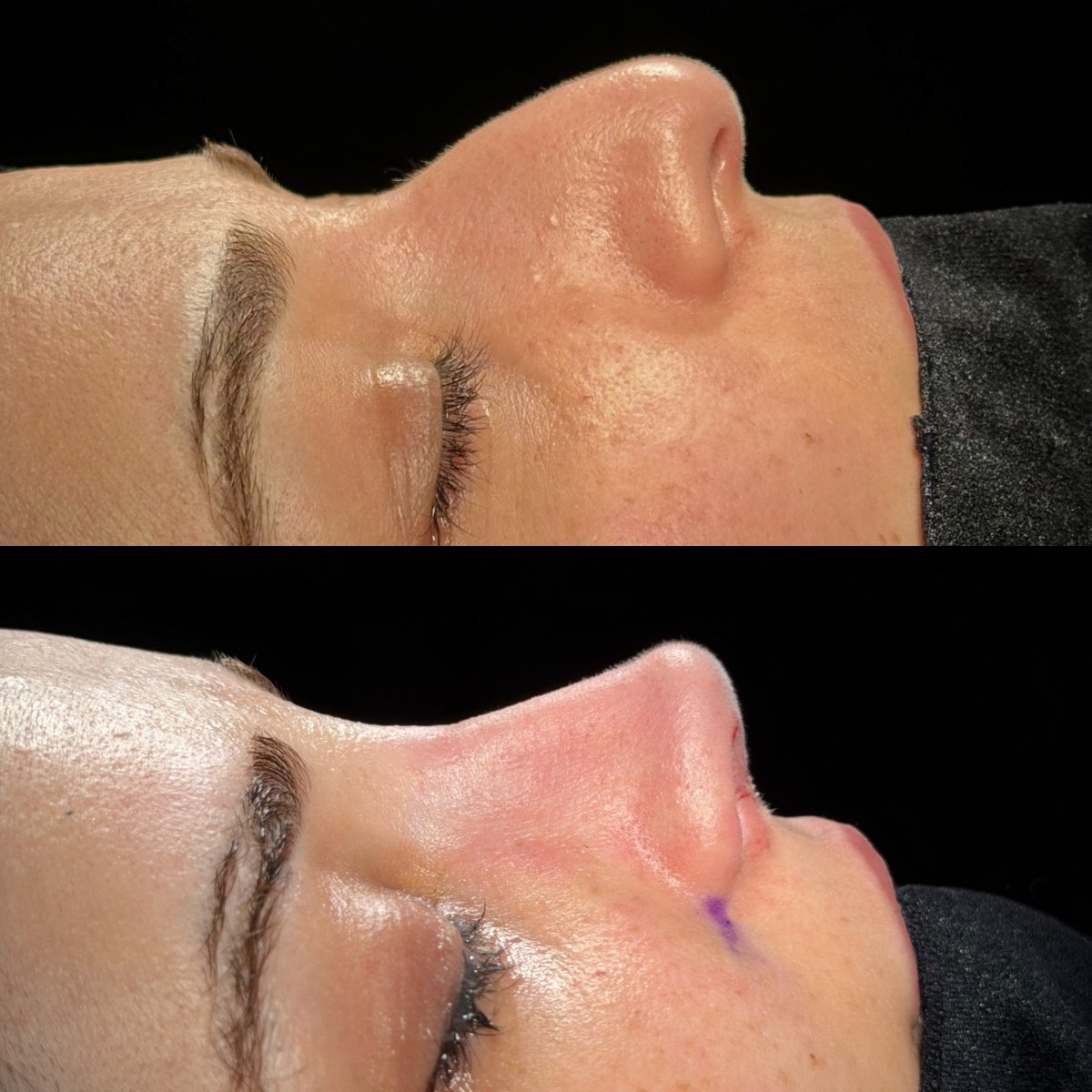 before and after photo