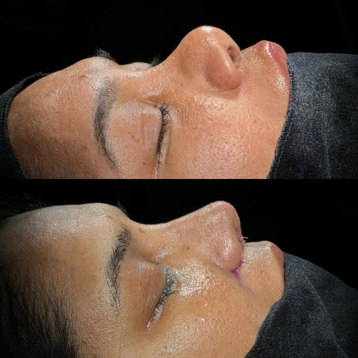 before and after photo