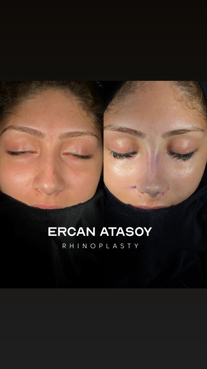 before and after photo