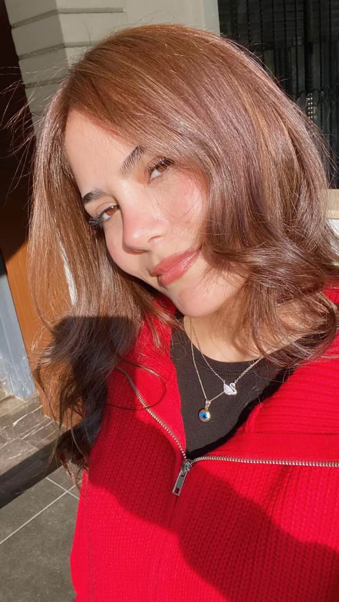نتيجة عملية تجميل الأنف تظهر شكل أنف مصقول ومظهر طبيعي بعد الإجراء
