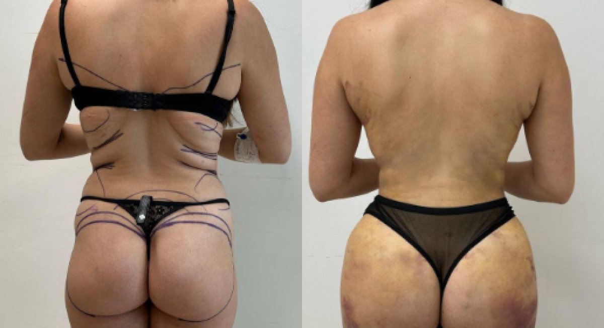 before and after photo