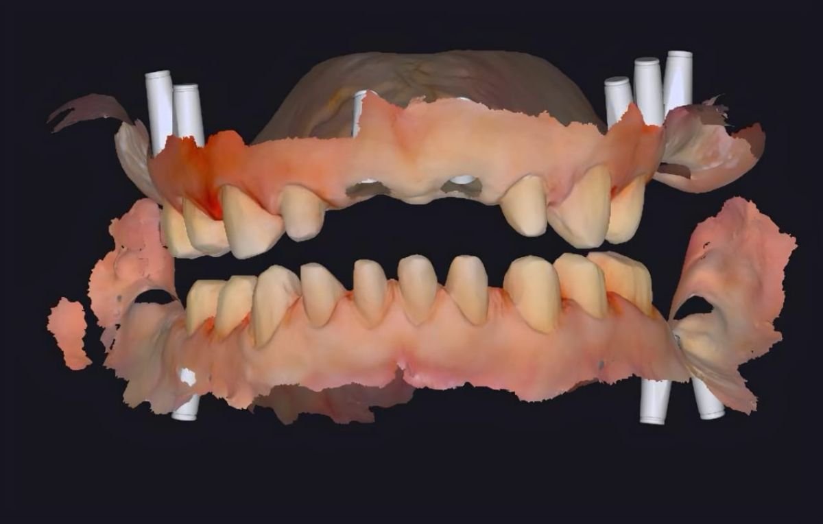 before and after photo