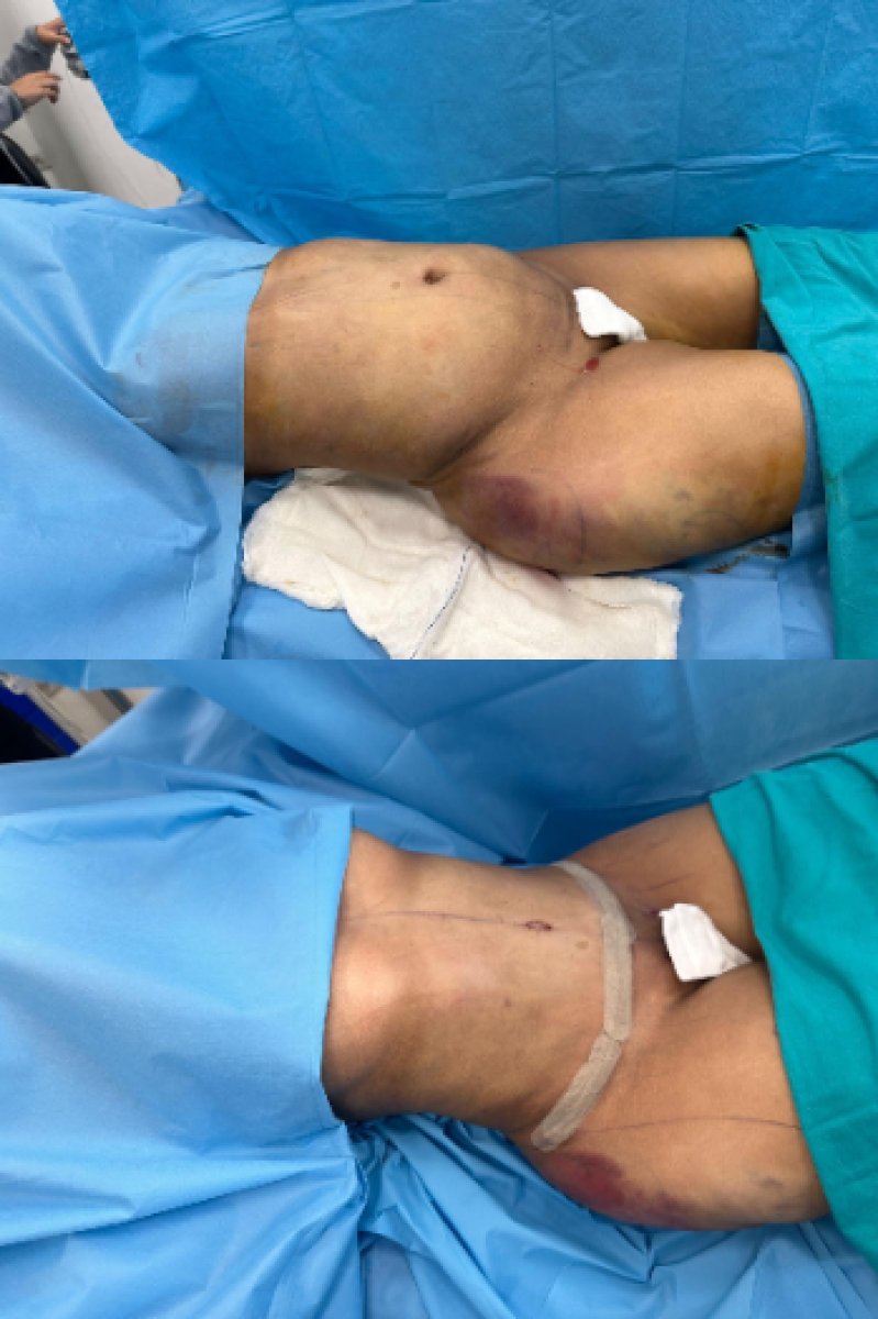 before and after photo