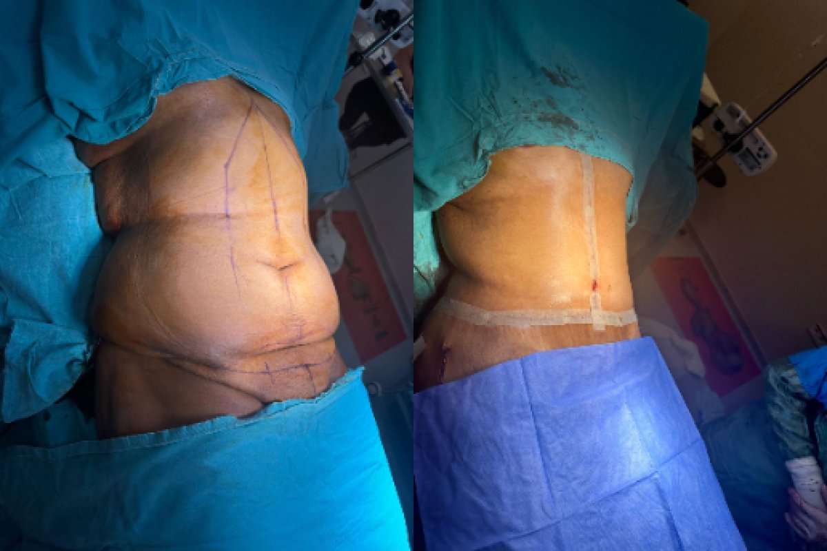 before and after photo