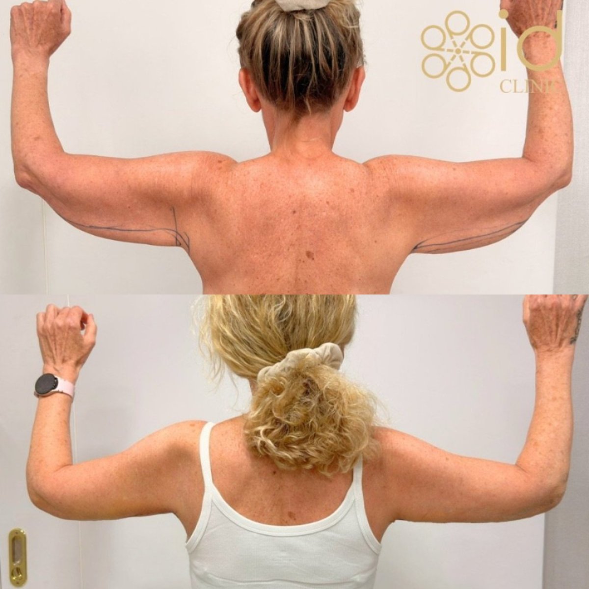 before and after photo