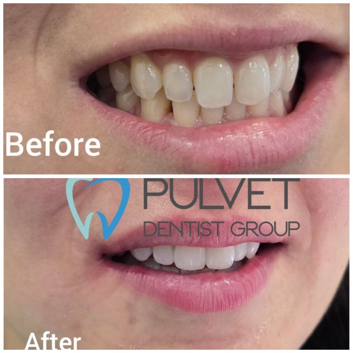 before and after photo