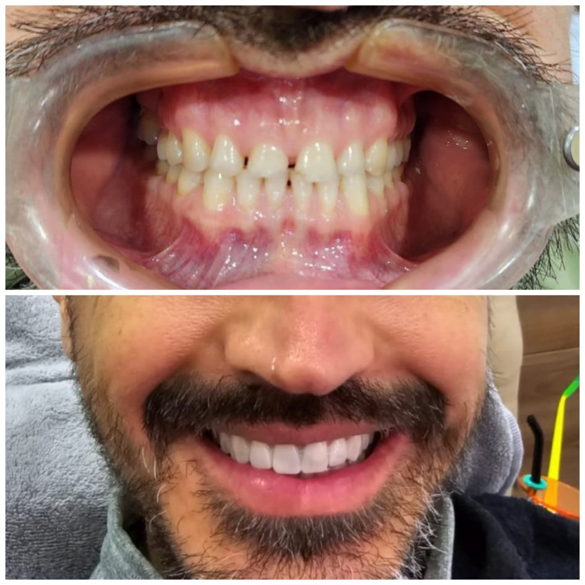before and after photo