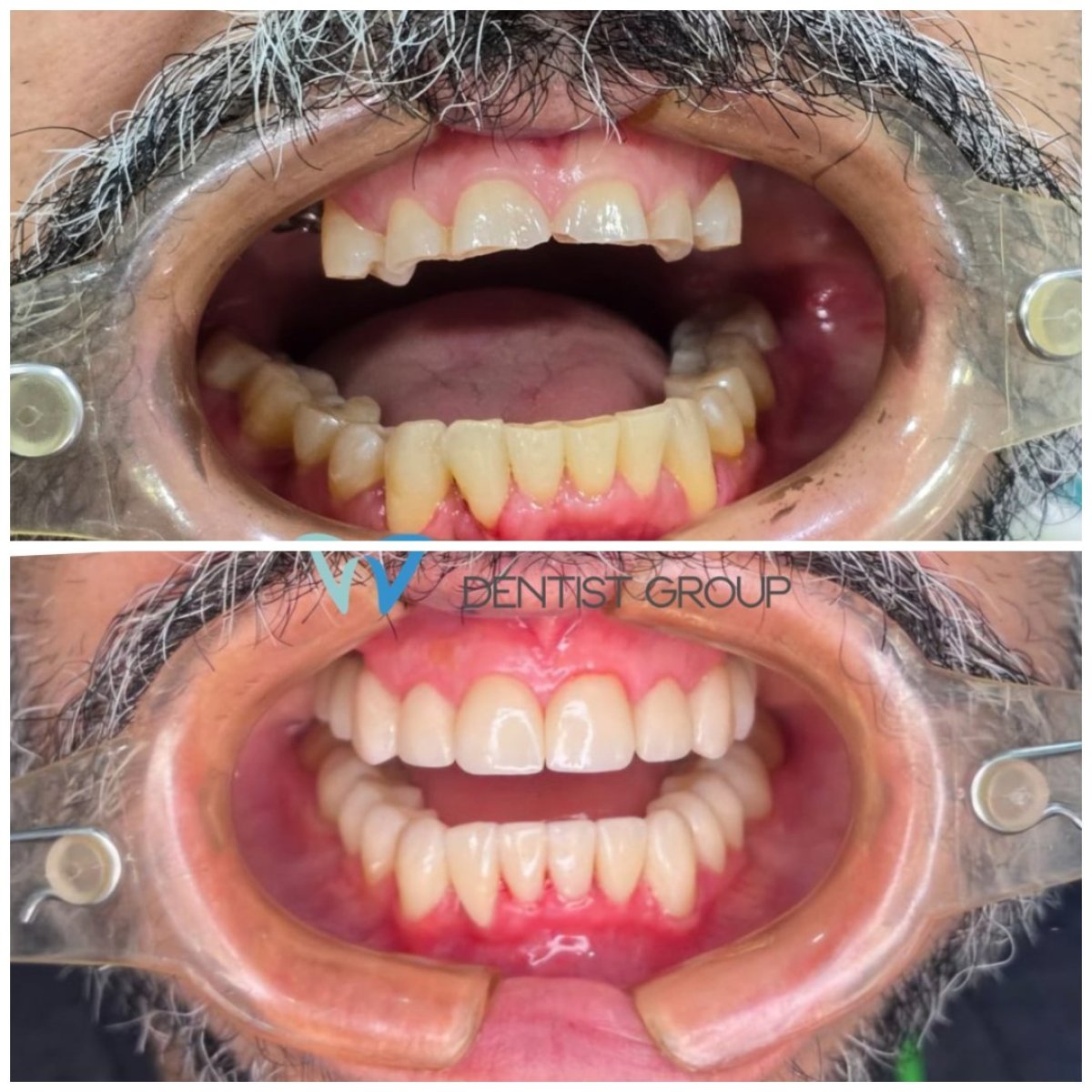 before and after photo