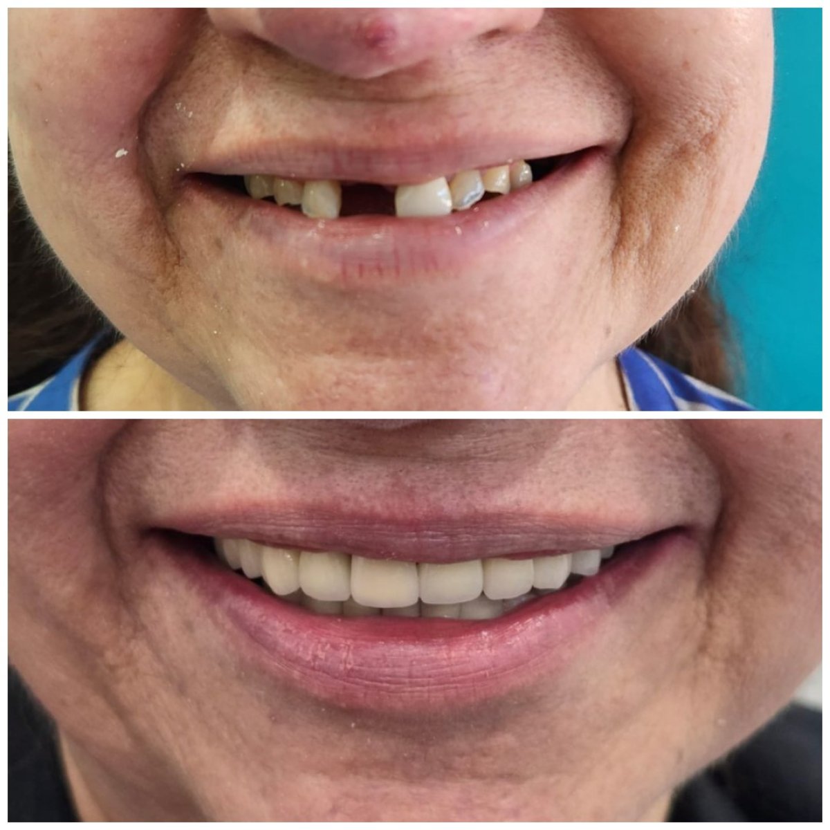before and after photo