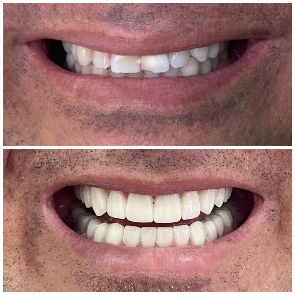 before and after photo