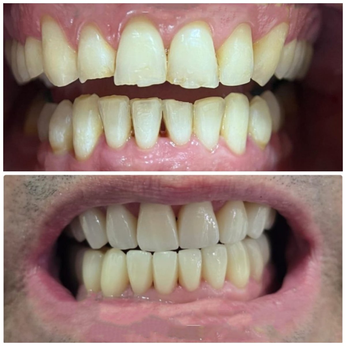 before and after photo