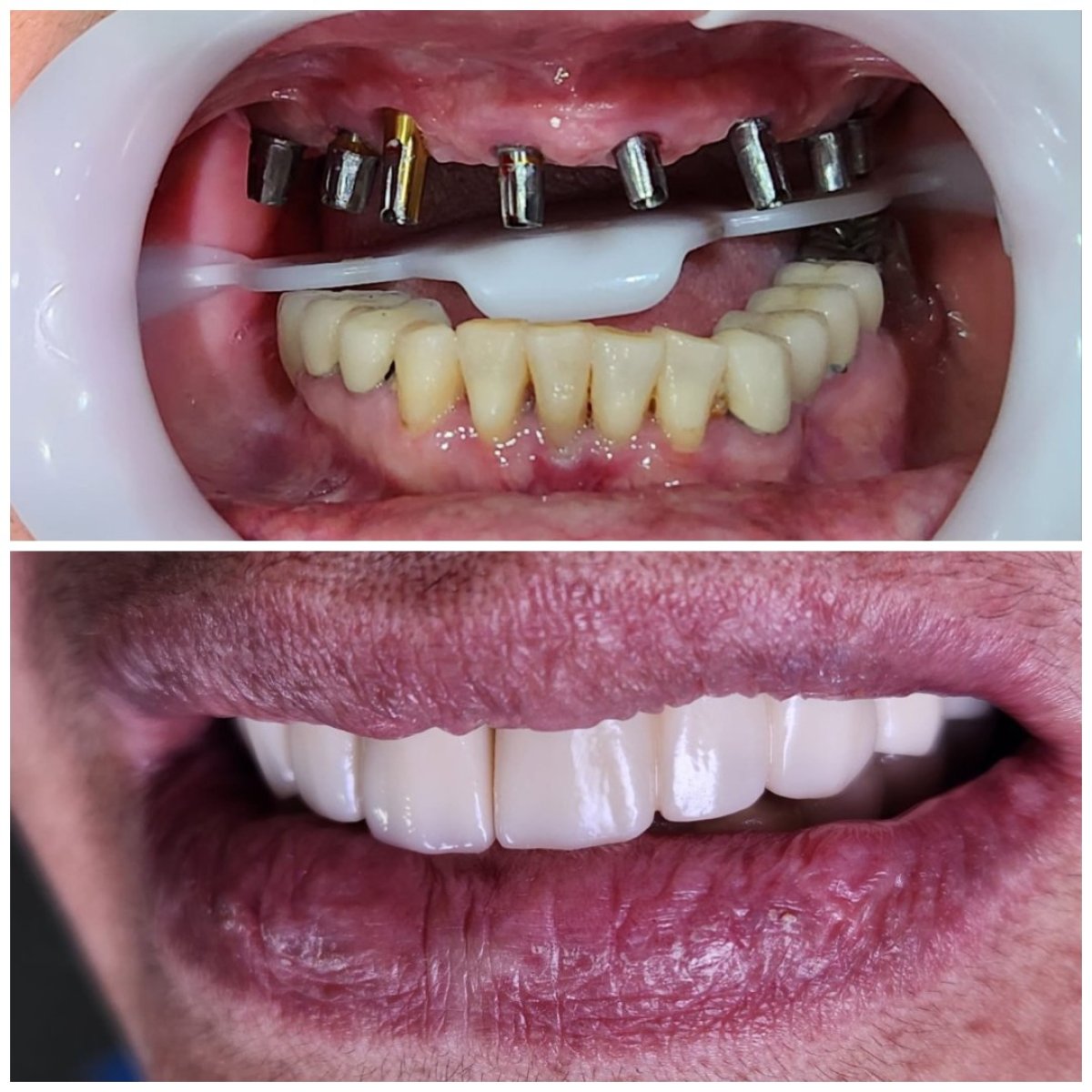 before and after photo