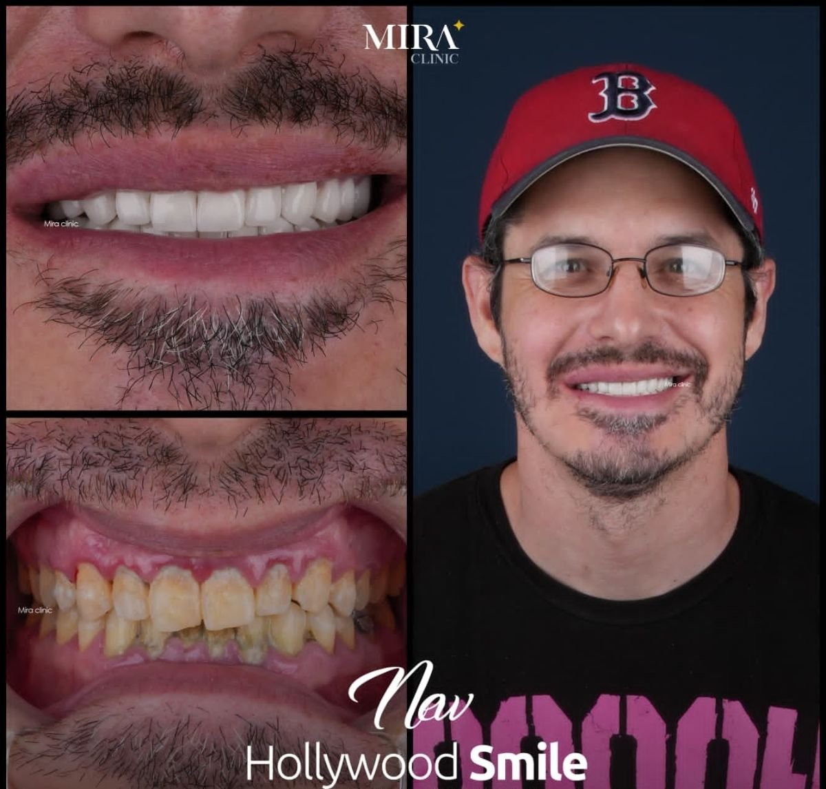 before and after photo