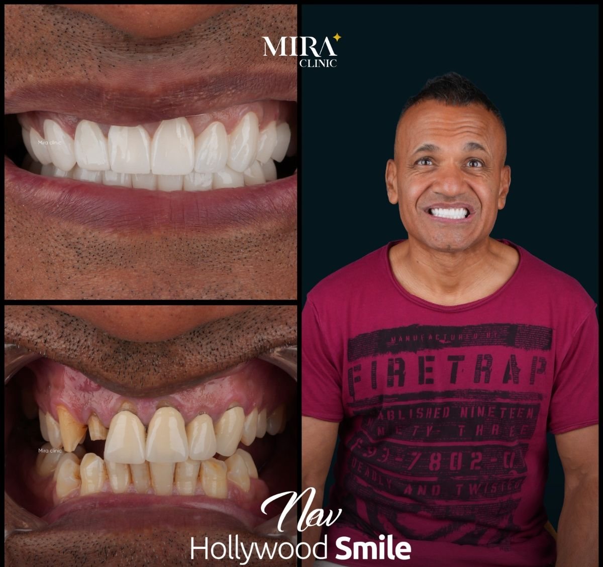before and after photo