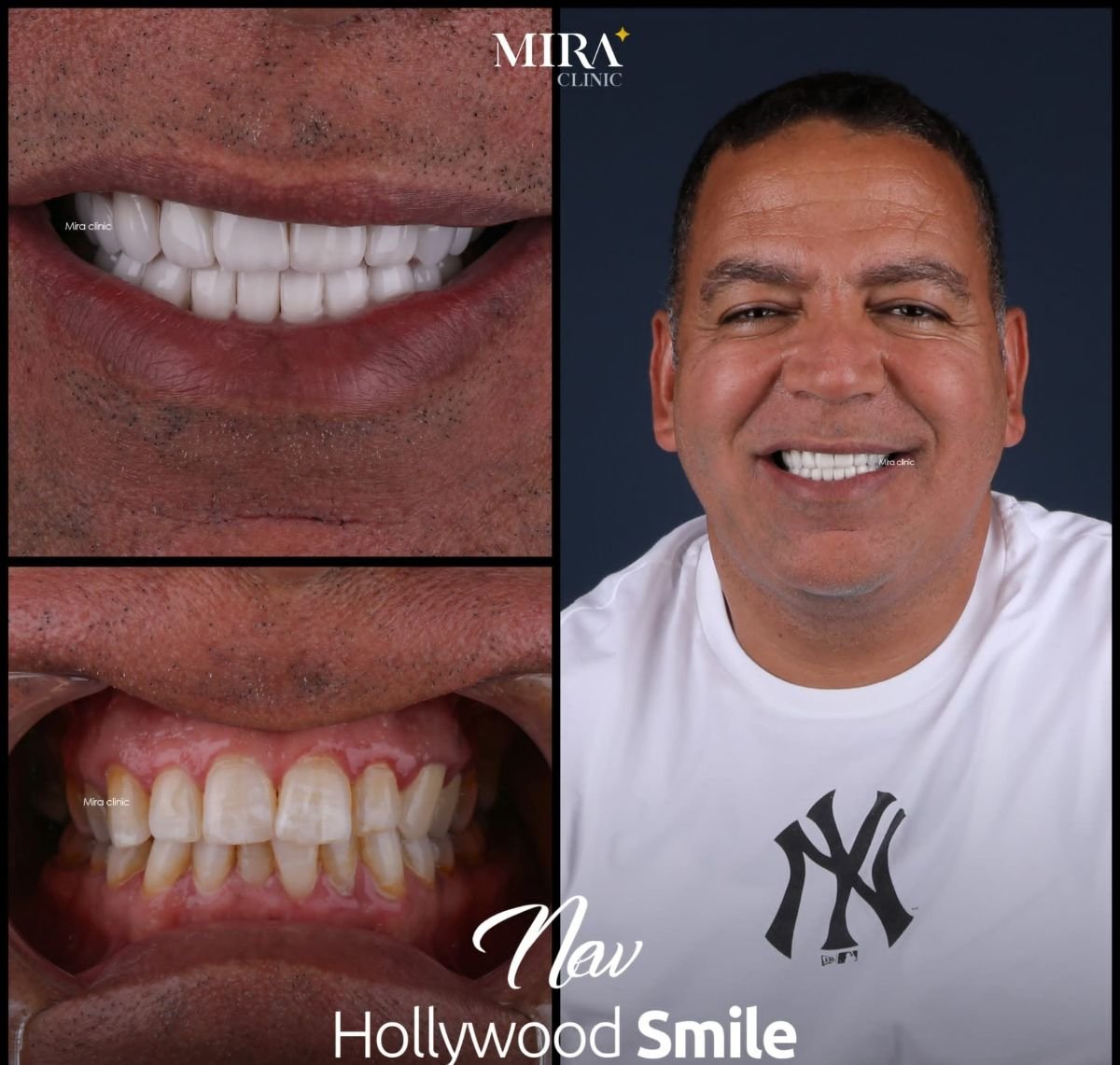 before and after photo