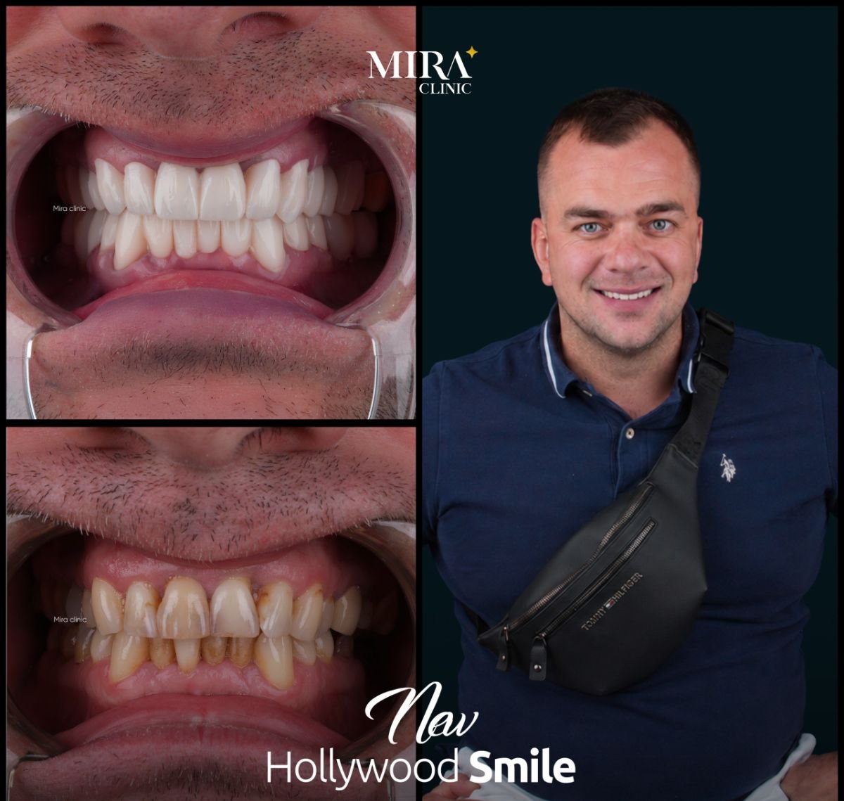 before and after photo
