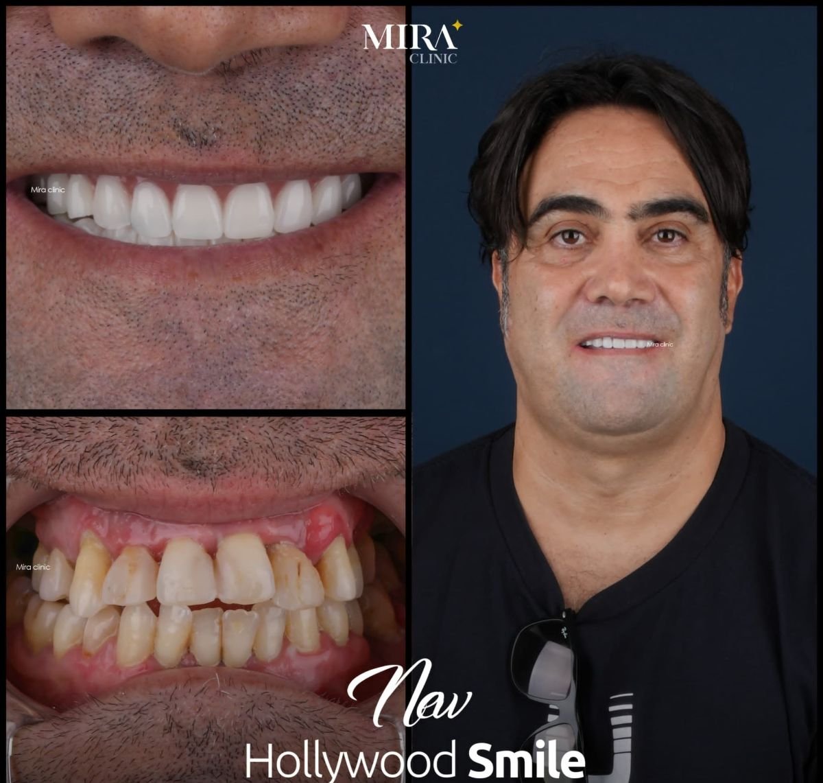 before and after photo