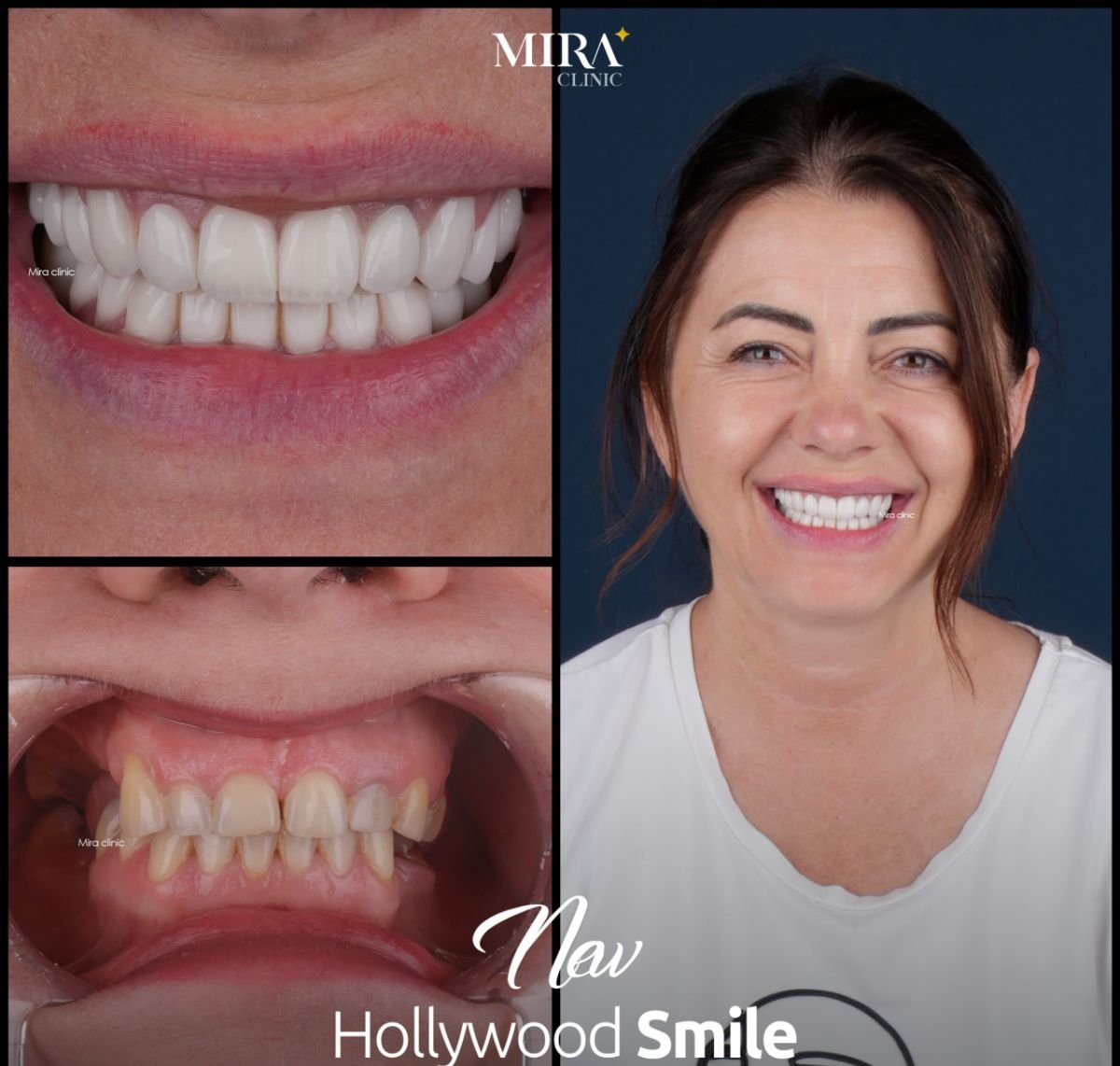before and after photo