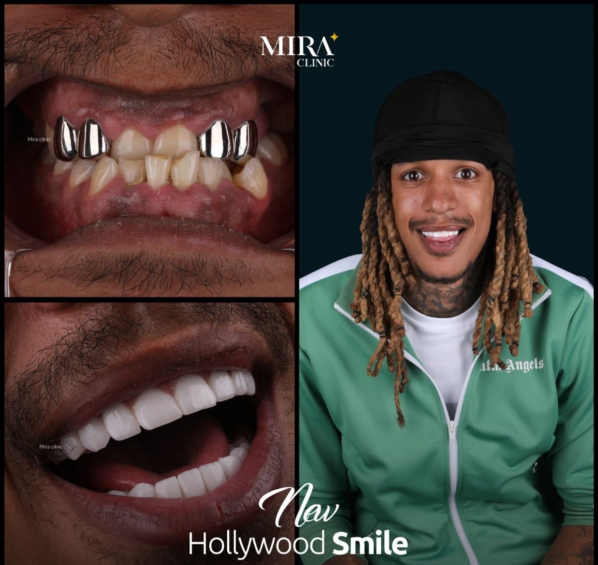 before and after photo
