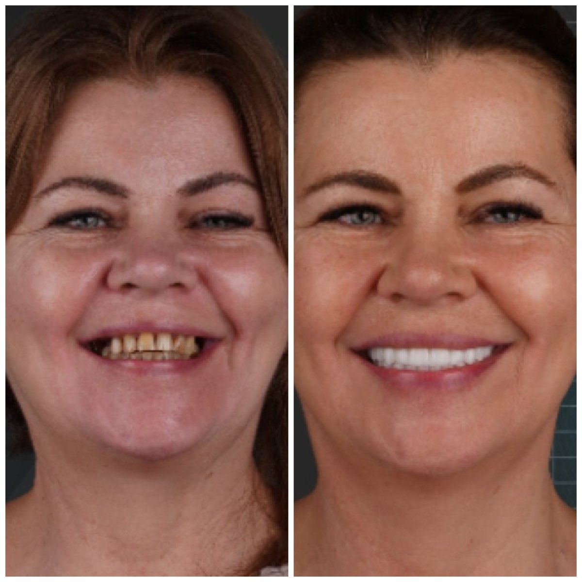 before and after photo