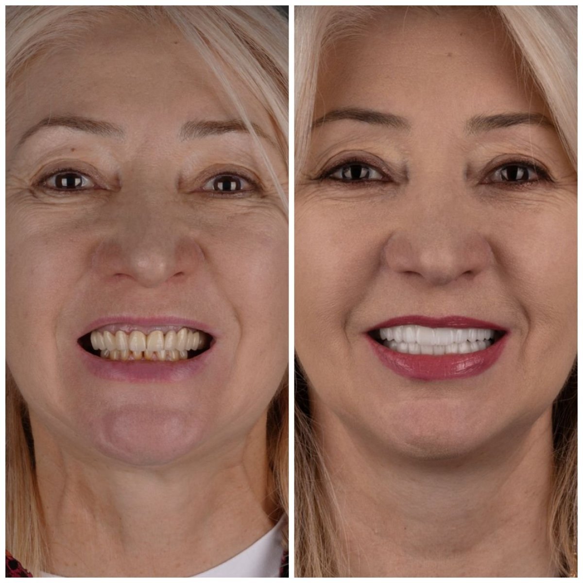 before and after photo