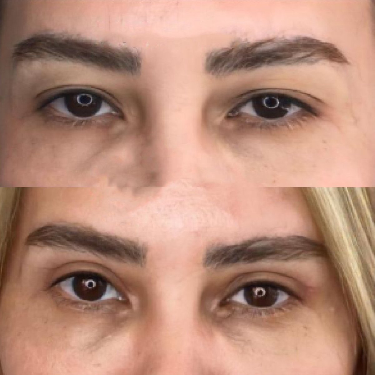 before and after photo