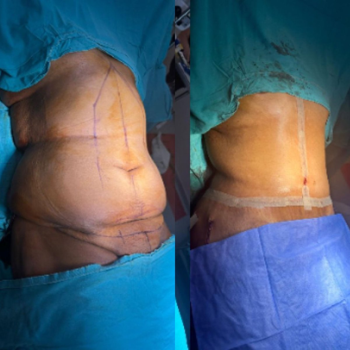 before and after photo