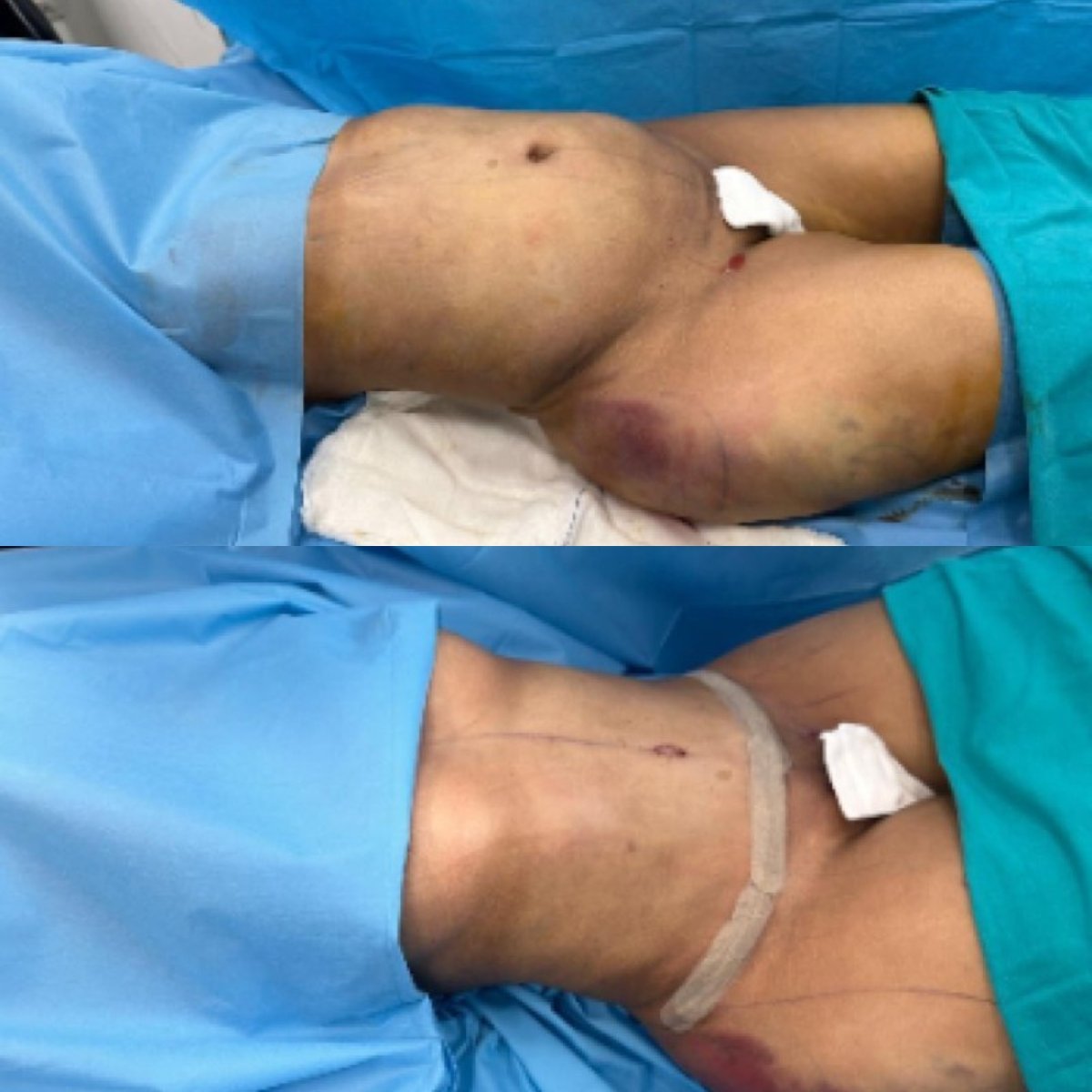 before and after photo