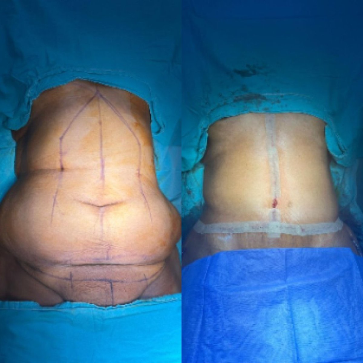 before and after photo