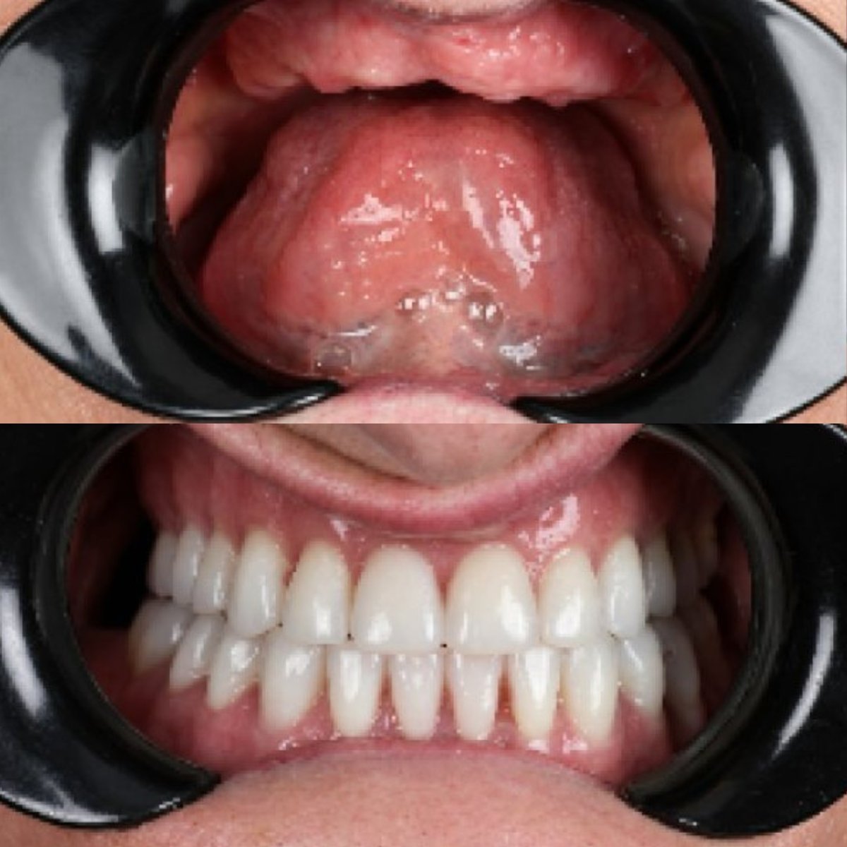 before and after photo