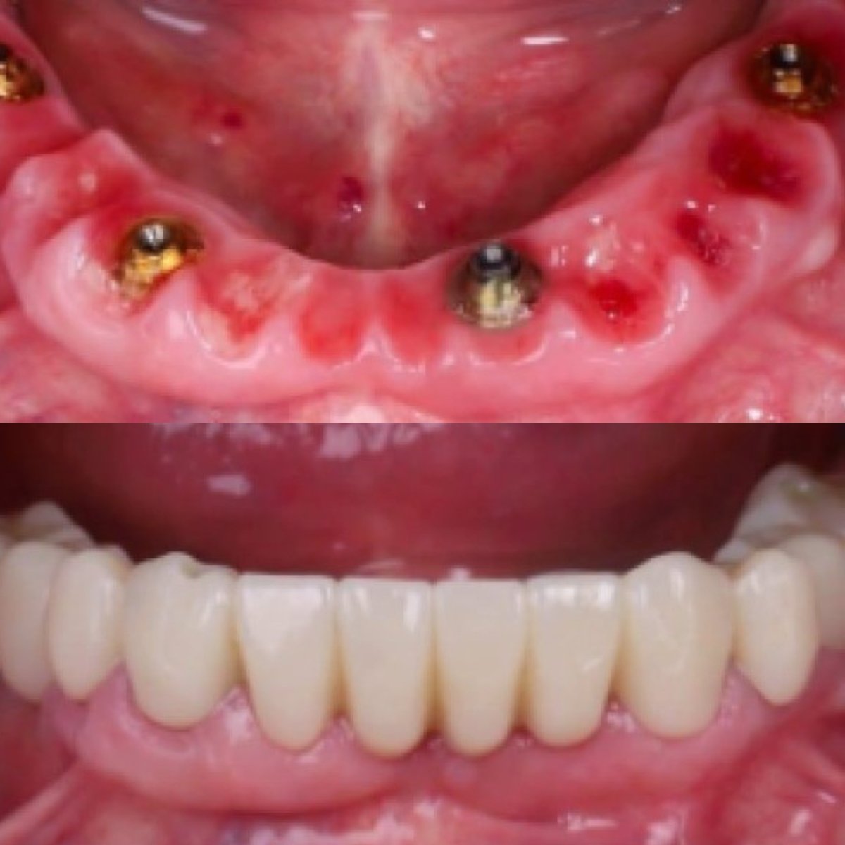 before and after photo