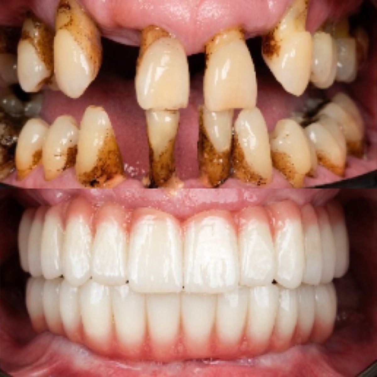 before and after photo