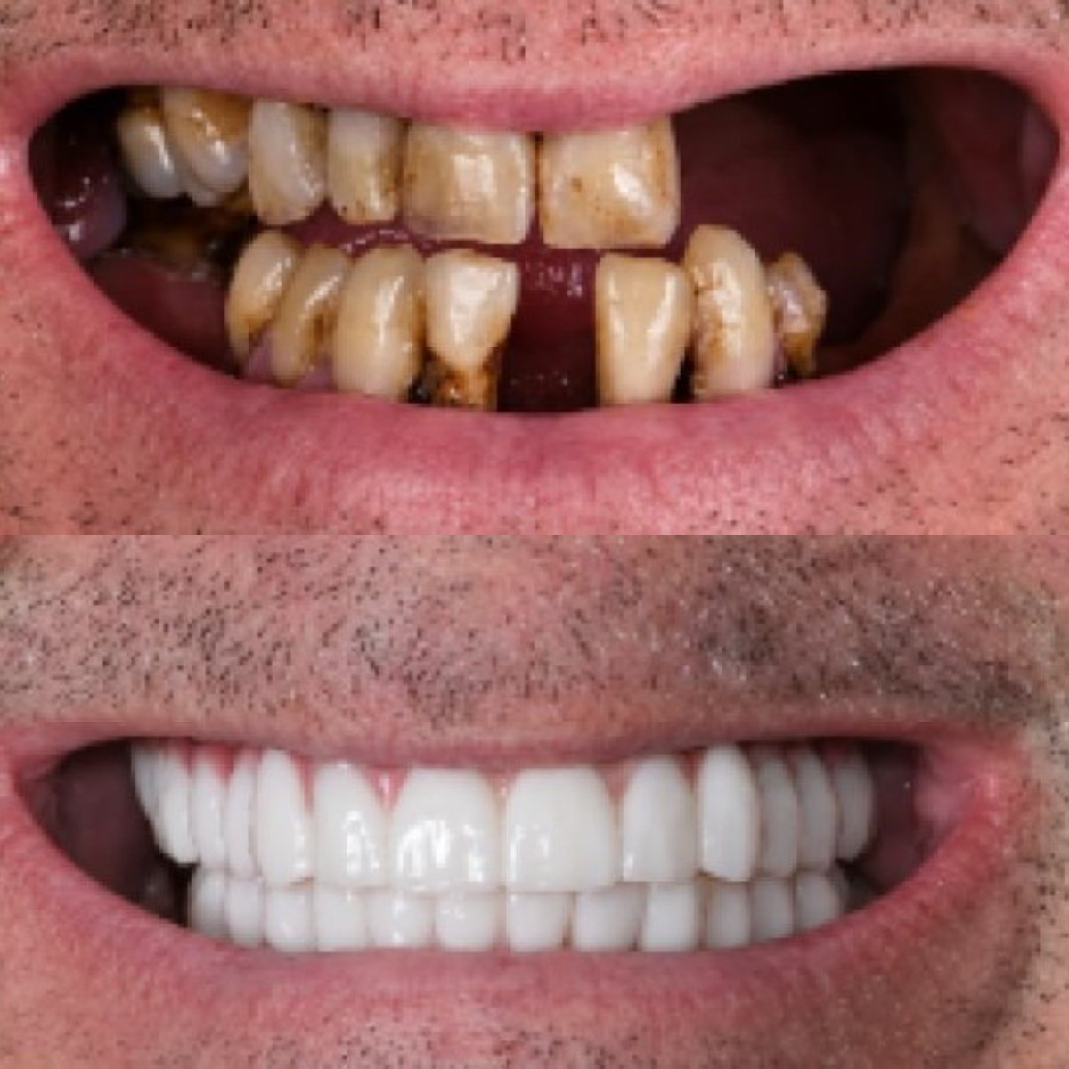 before and after photo