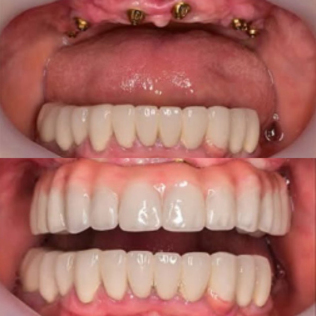 before and after photo