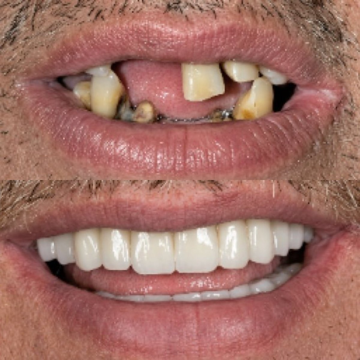 before and after photo