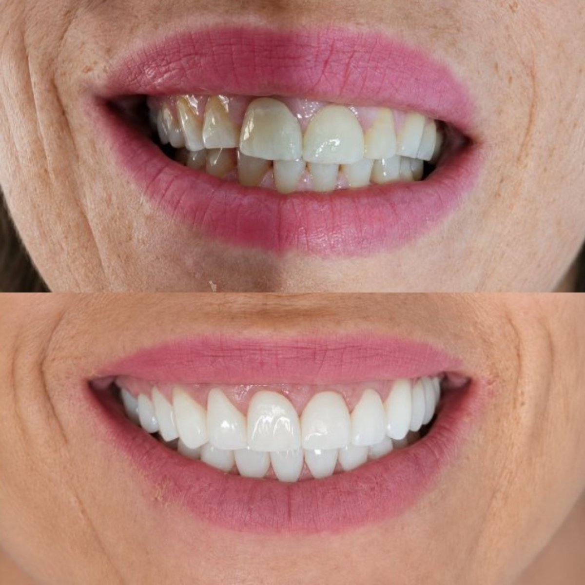 before and after photo