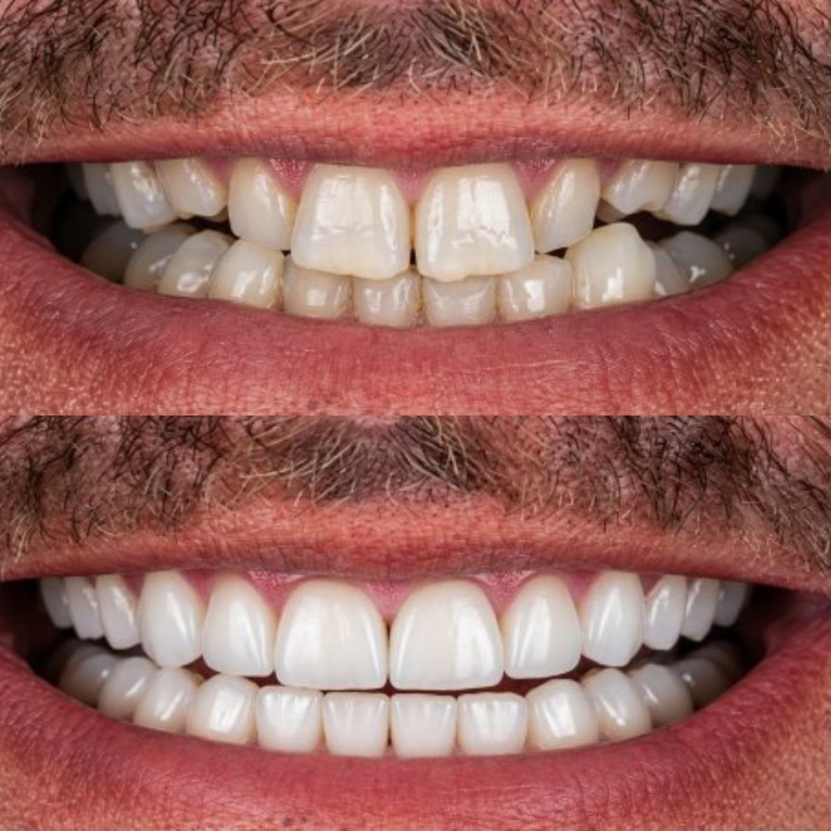 before and after photo