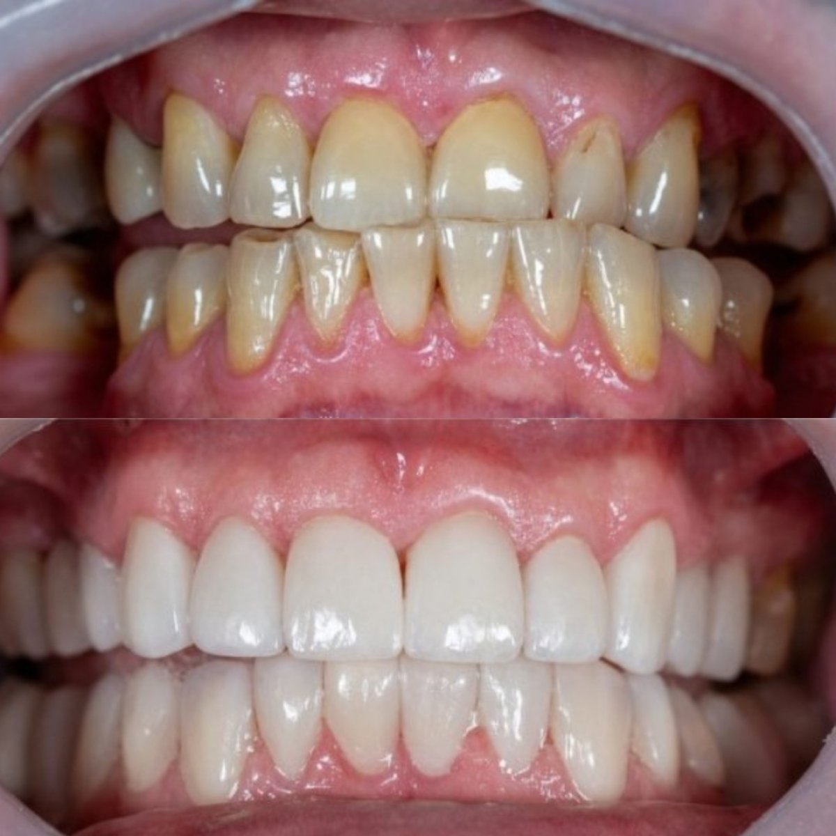 before and after photo